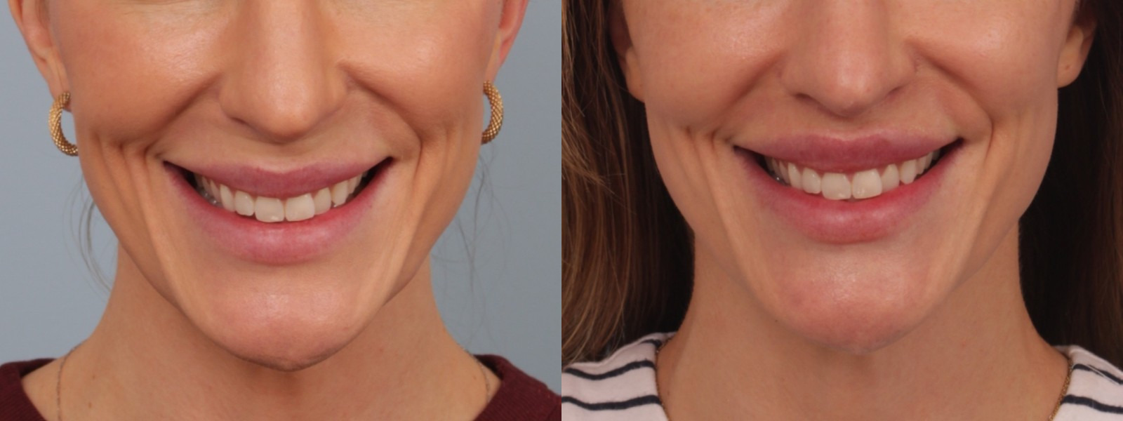 before_after_img