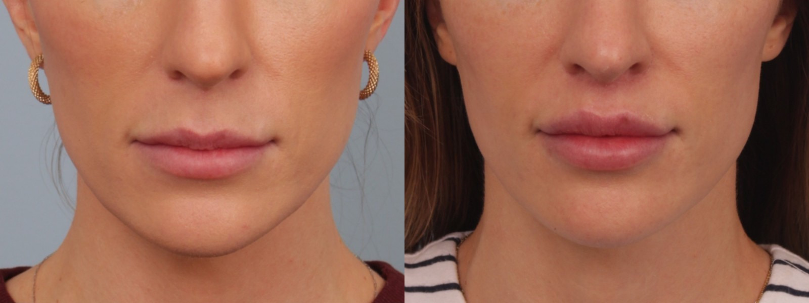 before_after_img