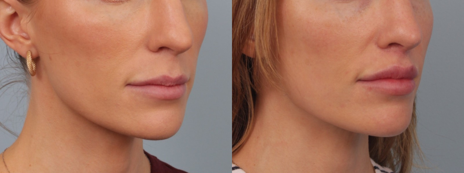 before_after_img