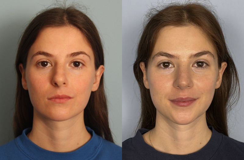 combined-image