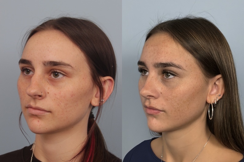before_after_img