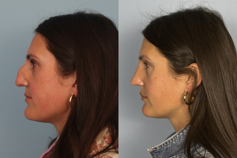 before_after_img