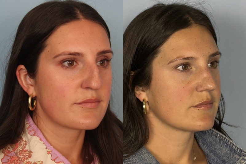 before_after_img