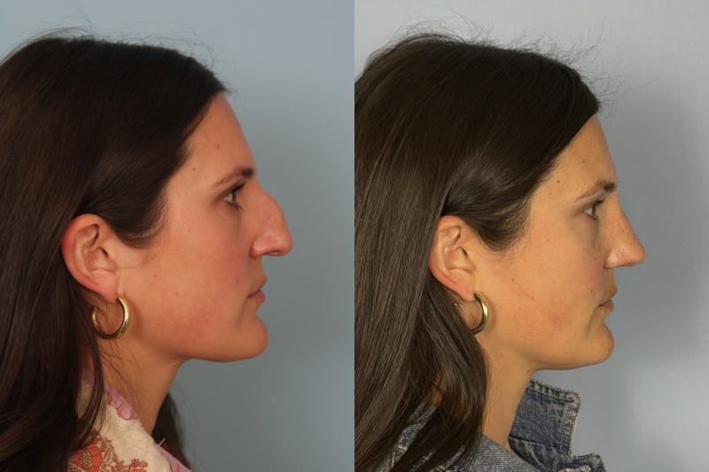 before_after_img