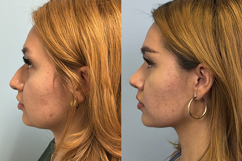 before_after_img