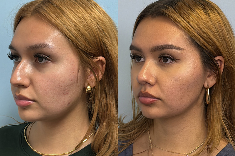before_after_img
