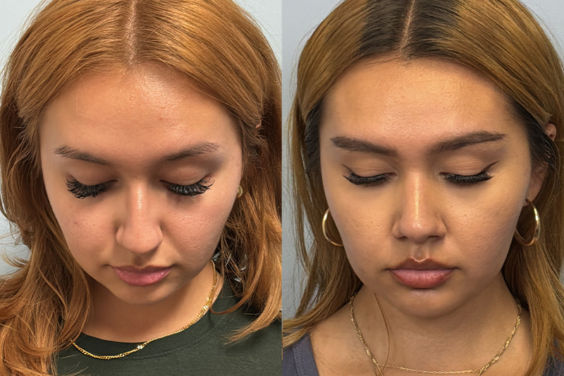 before_after_img
