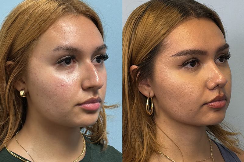 before_after_img