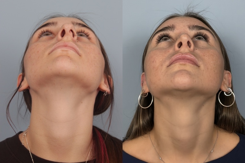 before_after_img