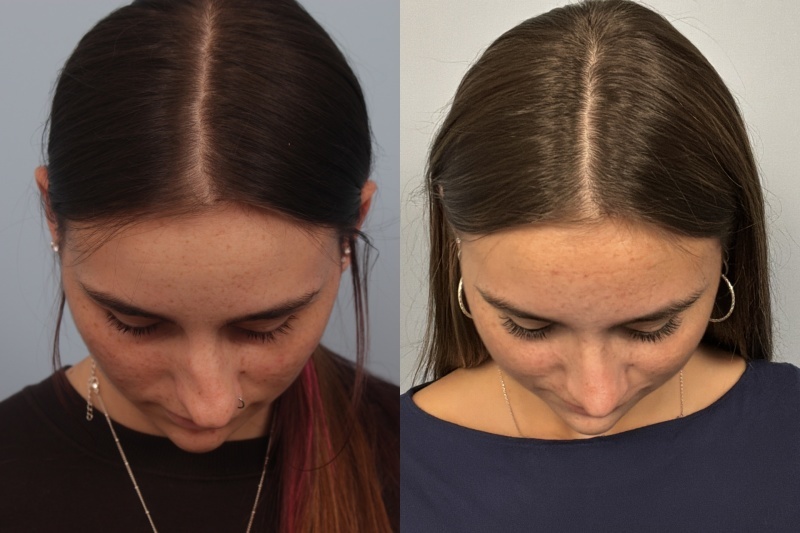 before_after_img